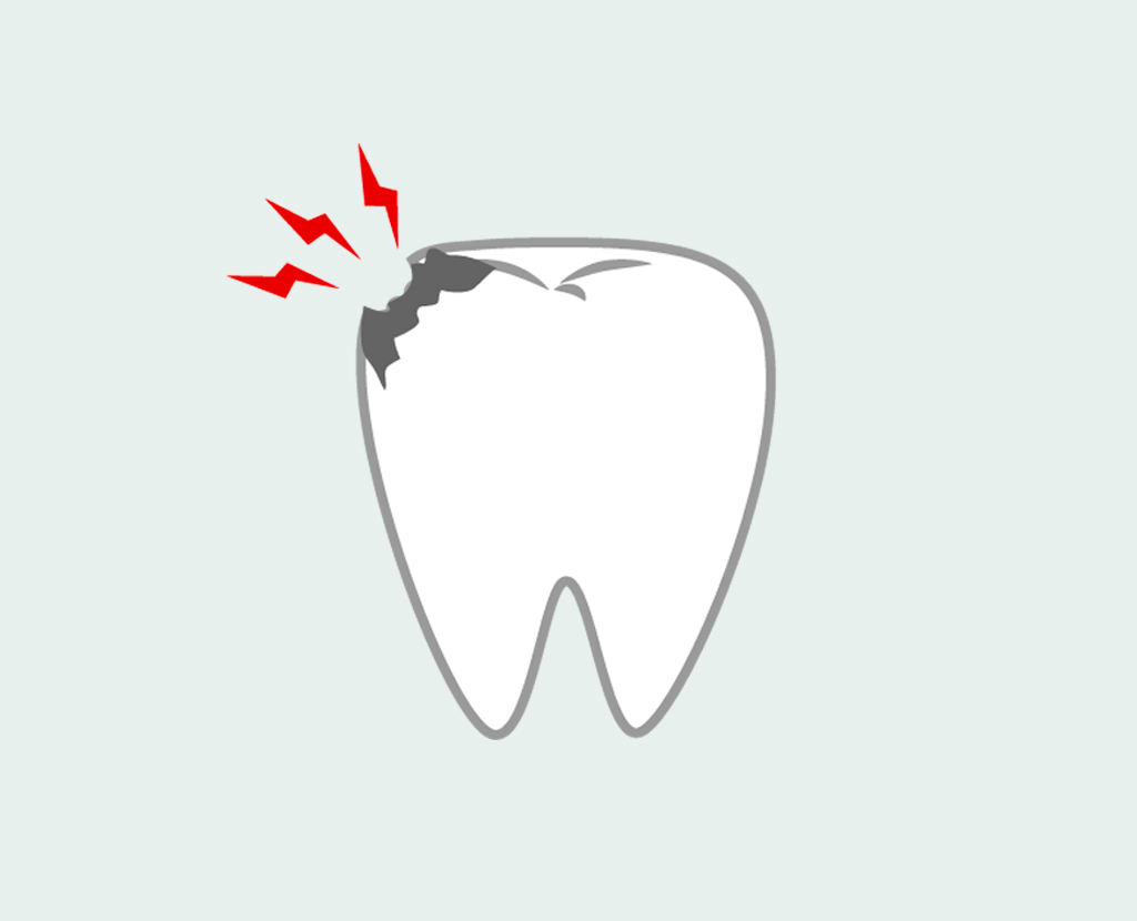 Сонник выпадение зубов без крови. Зуб шатается что делать. Разрушение эмали зубов. Во мне шатался зуб.