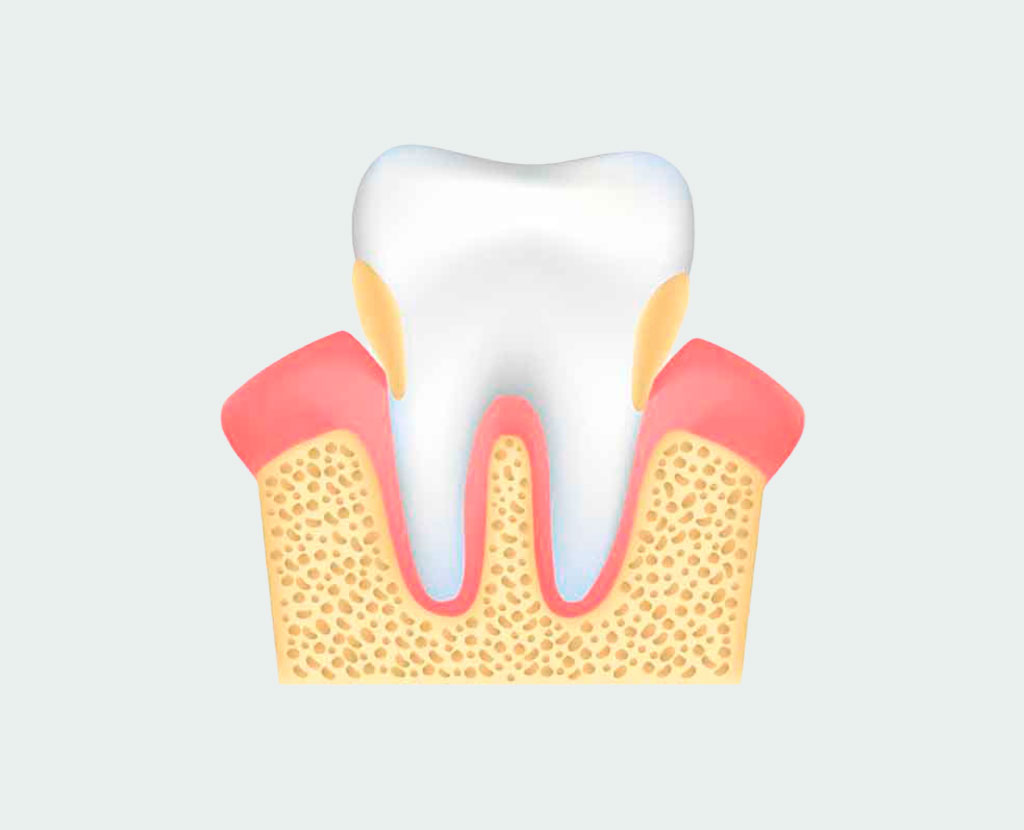 Виды зубов
