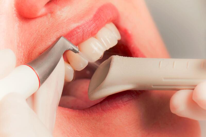 Как избежать появления кариеса на зубах: полезные советы и рекомендации